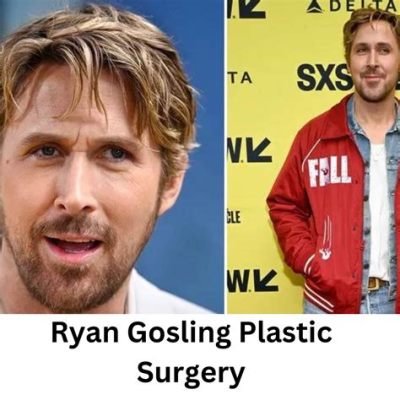 Has Ryan Gosling Had Plastic Surgery? Exploring the Rumors and Realities